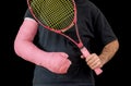 Young man in an arm cast after a tennis accident Royalty Free Stock Photo