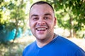 Young man in a blue T-shirt with a chipped tooth Royalty Free Stock Photo