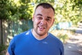 Young man in a blue T-shirt with a chipped tooth Royalty Free Stock Photo