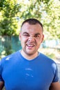 Young man with a chipped tooth Royalty Free Stock Photo