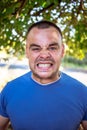 Young man with a chipped tooth Royalty Free Stock Photo