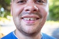 Young man with a chipped tooth Royalty Free Stock Photo