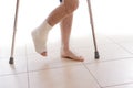 Young man with a broken ankle and a leg cast Royalty Free Stock Photo