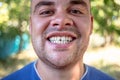 Young man with a chipped tooth Royalty Free Stock Photo