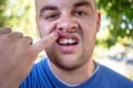 Young man with a chipped tooth Royalty Free Stock Photo