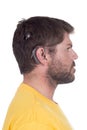 Young man with cochlear implant