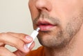 Young man with cold sore applying cream on lips against light background, closeup Royalty Free Stock Photo