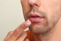 Young man with cold sore applying cream on lips against light background Royalty Free Stock Photo