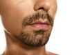 Young man with cold sore on lips against background, closeup Royalty Free Stock Photo