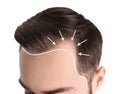 Young man with hair loss problem on white background Royalty Free Stock Photo