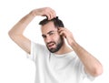 Young man with hair loss problem Royalty Free Stock Photo