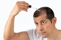 man hair treatment Royalty Free Stock Photo