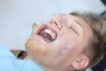 A young man installs braces in a dental clinic. Alignment of the dentition or bite.A dental expander.The concept of