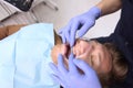 A young man installs braces at the dental clinic. Unrecognizable doctor orthodontist. Hands in protective gloves. Health care