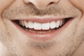 Young Man With Perfect White Teeth Royalty Free Stock Photo