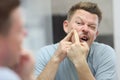 Young man presses pimple while standing in front of mirror in bathroom