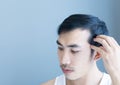 Young man serious hair loss problem for health care medical and shampoo product concept, selective focus Royalty Free Stock Photo