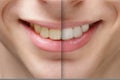 Young man smile before and after teeth whitening Royalty Free Stock Photo