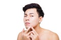 young man Squeezing pimple