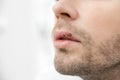 Young man suffering from herpes on his mouth