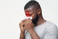 Young man suffering from sinusitis, touching nose with napkin Royalty Free Stock Photo