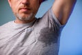 Young man with sweat under the armpit and have a foul odor. Health and medicine concept