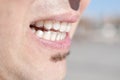 Young man wearing clear retainers