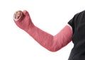 Young man wearing a red long arm plaster fiberglass cast Royalty Free Stock Photo