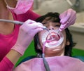 Patient with braces and cheek retractor