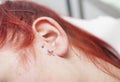 Young red-haired girl with piercing jewel just after to be pierced on ear skin Royalty Free Stock Photo