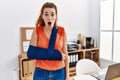Young redhead woman wearing arm on sling at the office scared and amazed with open mouth for surprise, disbelief face Royalty Free Stock Photo