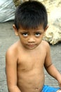 Young scavenger boy from the Smokey Mountain in Manila, Philippines