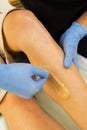 A young slender girl applies sugar paste for hair depilation on her legs. Close-up.