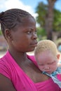 Young unidentified young black girl holding albino child in shade