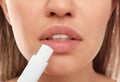 Young woman with cold sore applying lip balm