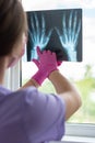 Young woman doctor looking at xray radiography images at clinic. Physician, surgeon reviewing scan of patient bones