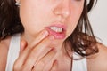 Young woman examining herpes in her face