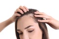 Young woman with hair loss problem on white background Royalty Free Stock Photo