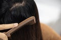 Young woman hair loss, with thin hair. Royalty Free Stock Photo