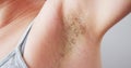 Young Woman With Hairy Armpit. Hair Removal Royalty Free Stock Photo