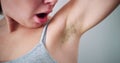 Young Woman With Hairy Armpit. Hair Removal Royalty Free Stock Photo