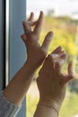 Young woman having rheumatoid arthritis exposing her hands. Hands and legs are deformed. She feels pain. Selected focus