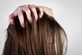 Young woman holding dirty greasy hair on gray background. Royalty Free Stock Photo