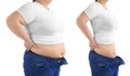 Young woman before and after liposuction operation