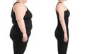 Young woman before and after liposuction operation