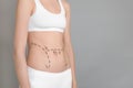 Young woman with marks on belly for cosmetic surgery Royalty Free Stock Photo