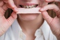 Young woman with metal braces on her teeth is chewing gum. The girl is eating gummy candy Royalty Free Stock Photo