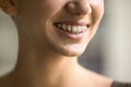 Young woman with metal brackets on teeth, close up Royalty Free Stock Photo