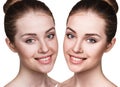 Young woman before and after retouch.