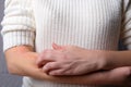 Young woman scratches her hands from itching. Allergic dermatitis. Skin disease vitiligo. Neurodermatitis disease, eczema or wool Royalty Free Stock Photo